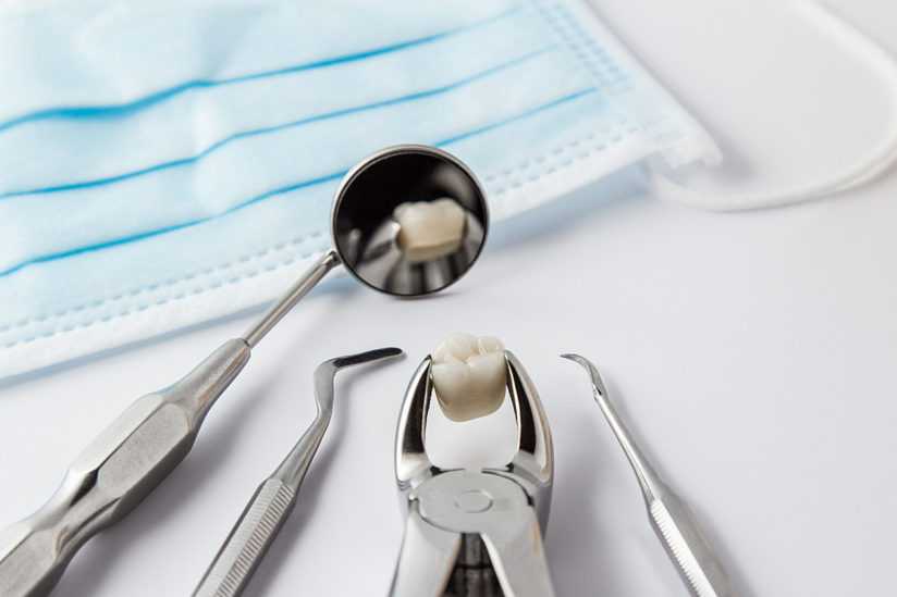 Простое удаление зуба – стоматолог-хирург