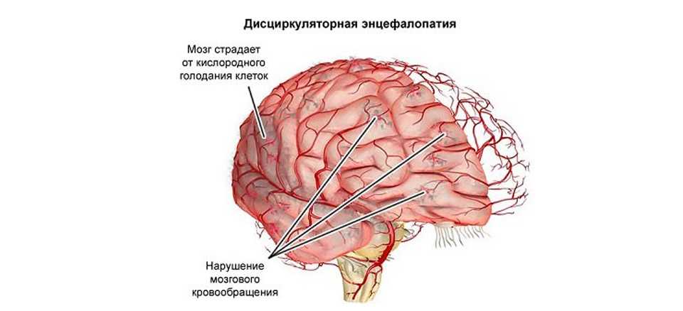 Дисциркуляторный характер