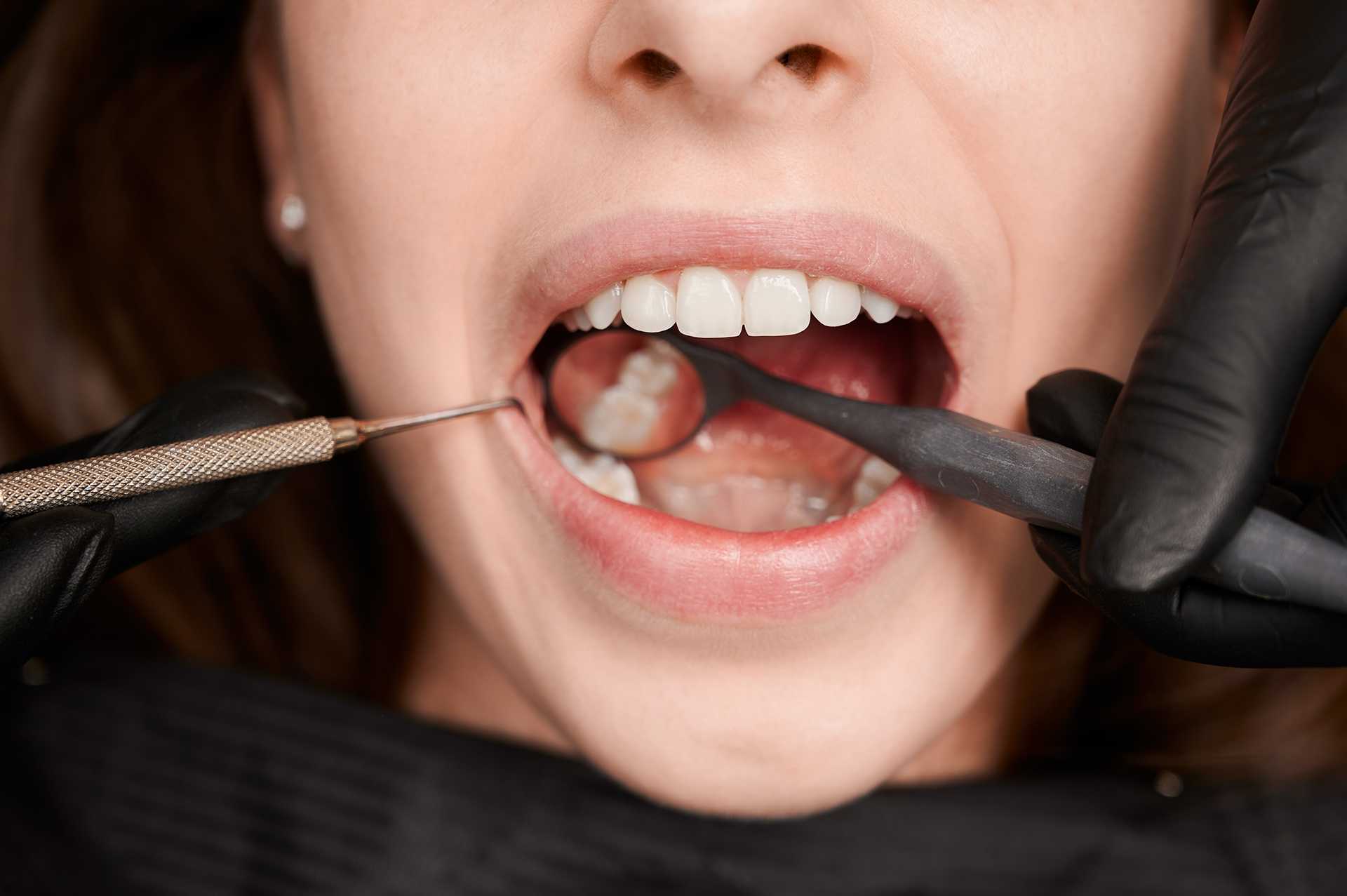 Лечение 3-канальных зубов в КДЦ №6