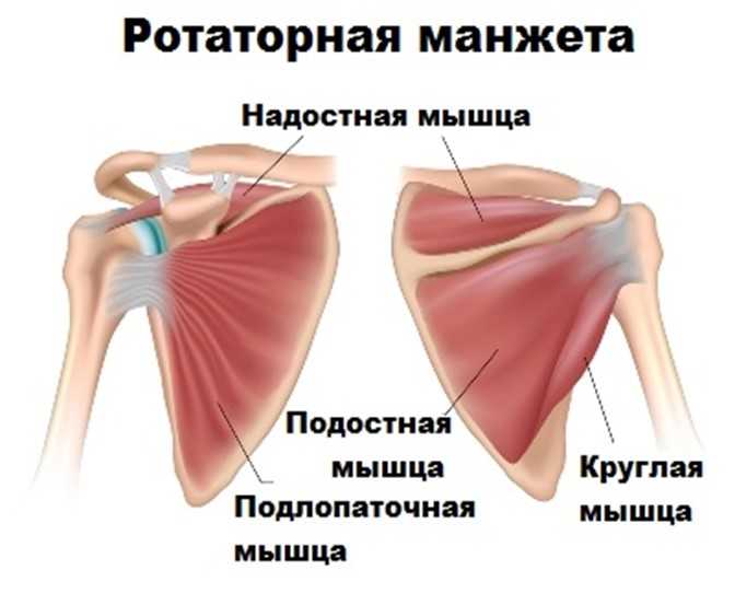 Повреждения сухожилия надостной мышцы плеча