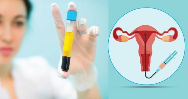 PRP-терапия в гинекологии