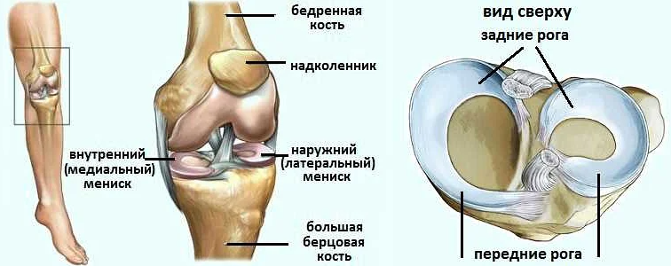 Лечение менисков коленных суставов
