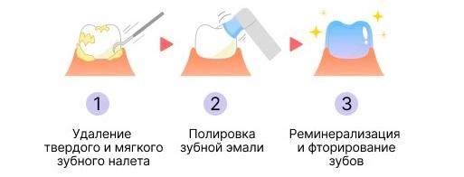 Для чего нужна гигиеническая чистка зубов и снятие зубного камня