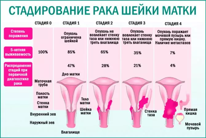 ВПЧ и рак шейки матки – есть ли связь?