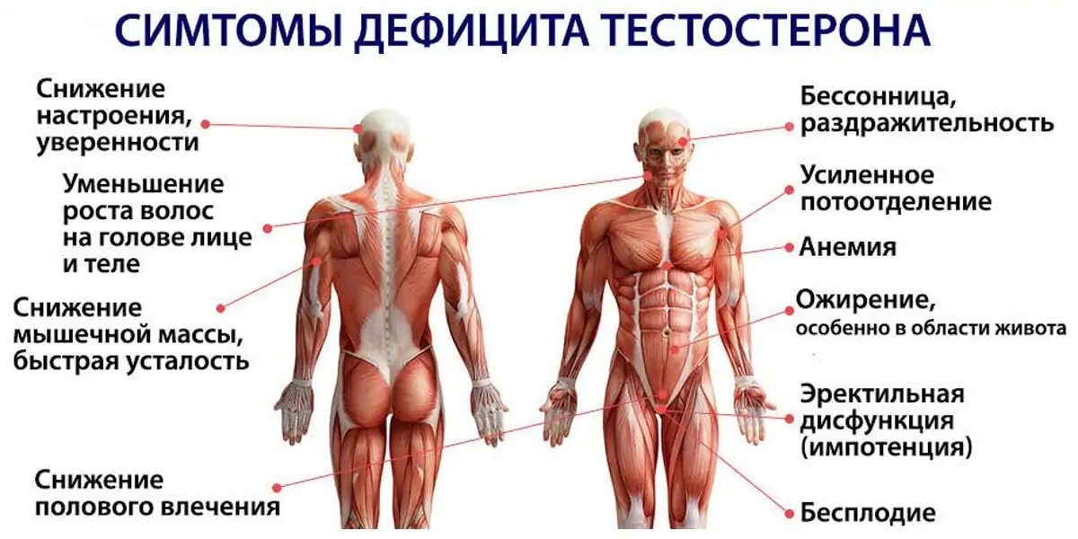 Андрогенный дефицит (гипогонадизм у мужчин) - диагностика, лечение